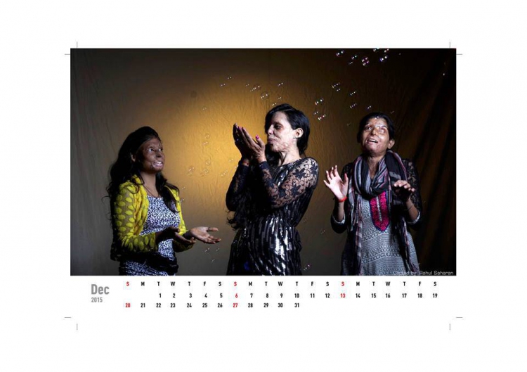 Смелое заявление жертвы кислотной атаки с помощью красной помады