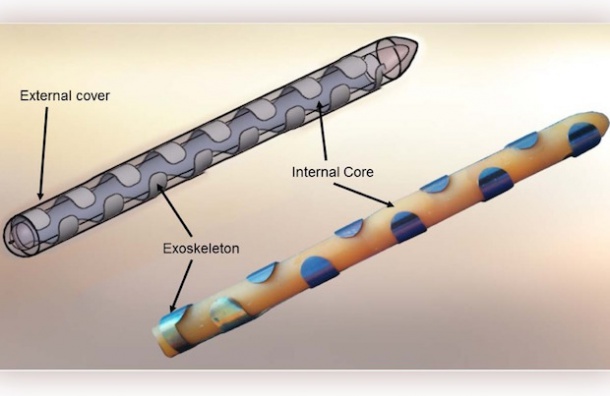 Экзоскелет для пениса поможет при эректильной дисфункции